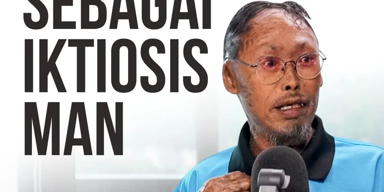 📍🟡 “Kalau pergi interview kerja, kami orang pertama yang kena reject.”