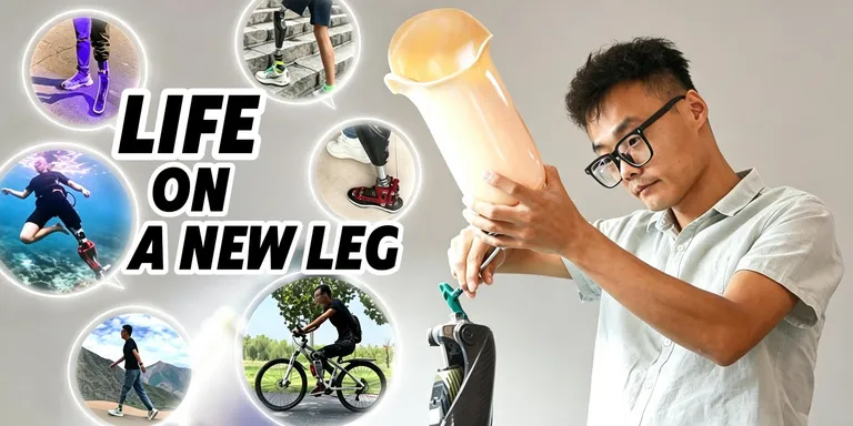 Mini Documentary | After losing his leg, he built a new way forward