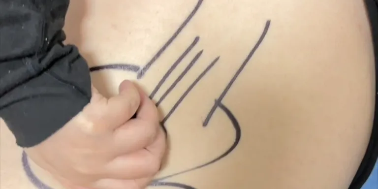 Guitar tummy